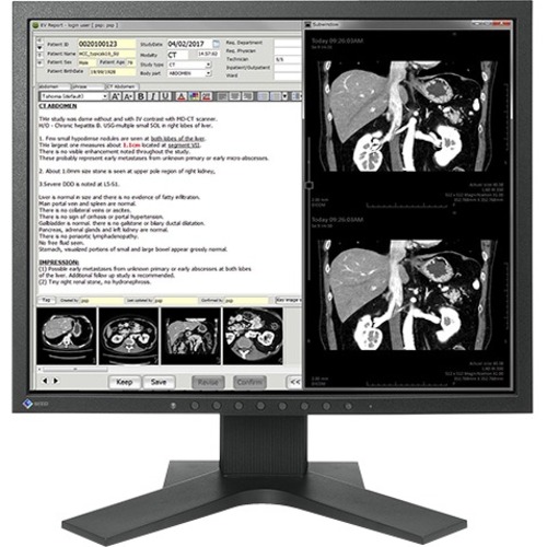 EIZO RadiForce MX194 19" Class SXGA LCD Monitor - 5:4 - Black