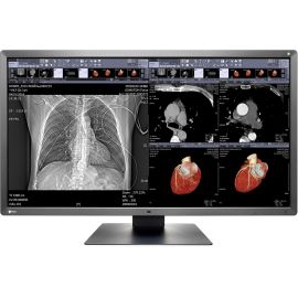 EIZO RadiForce MX315W 31