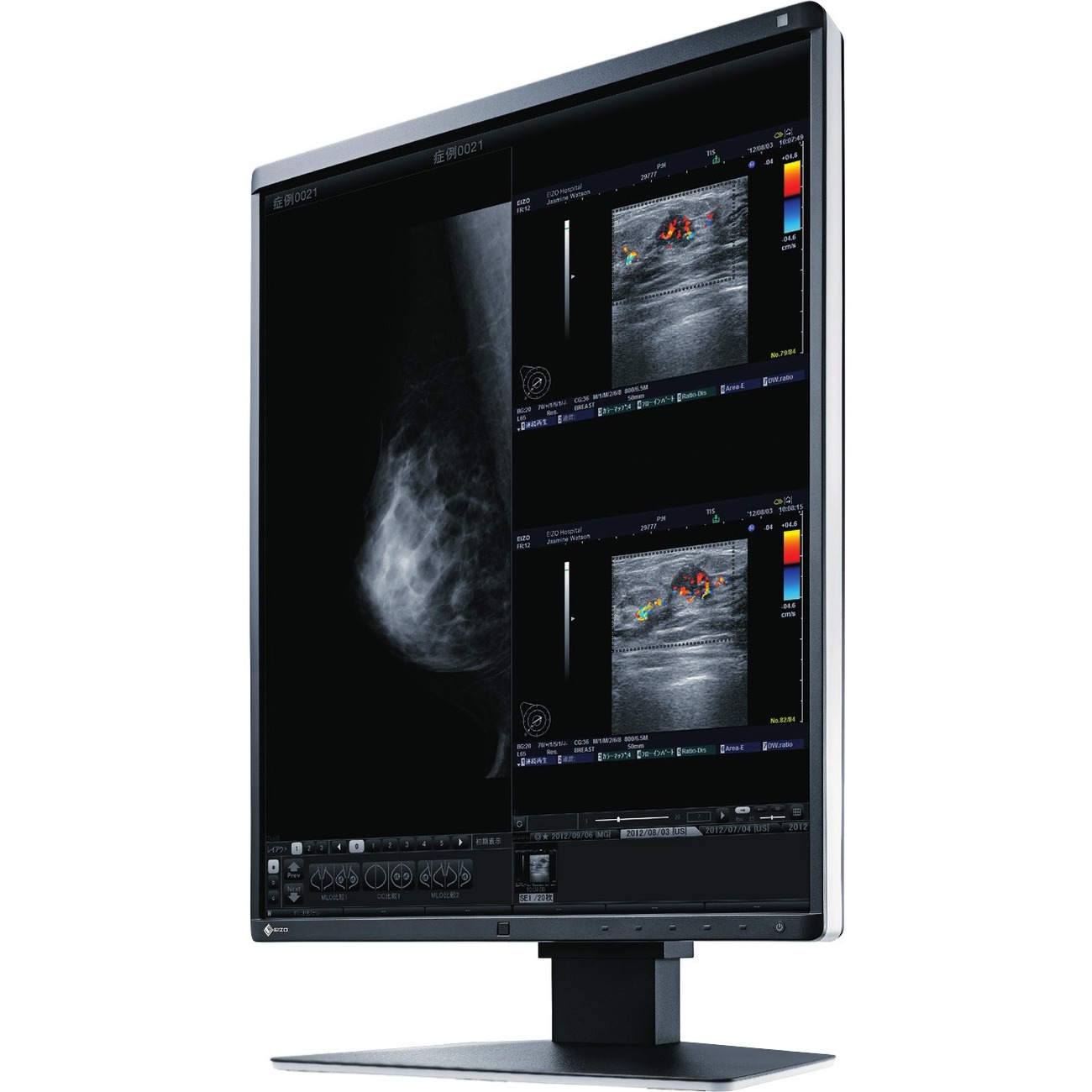 EIZO RadiForce RX560 21" Class QXGA LCD Monitor - 4:3 - Black
